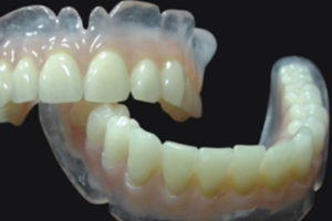 https://www.newwestminsterdenturist.com/wp-content/uploads/2018/03/dentures-with-clear-resin-300x200.jpg
